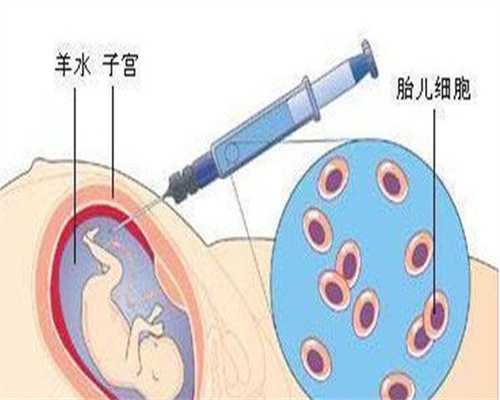 辅助生殖科普